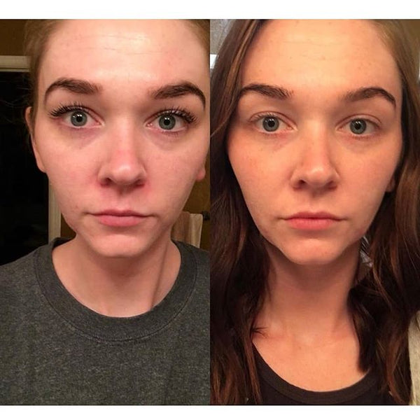 My skin has drastically improved