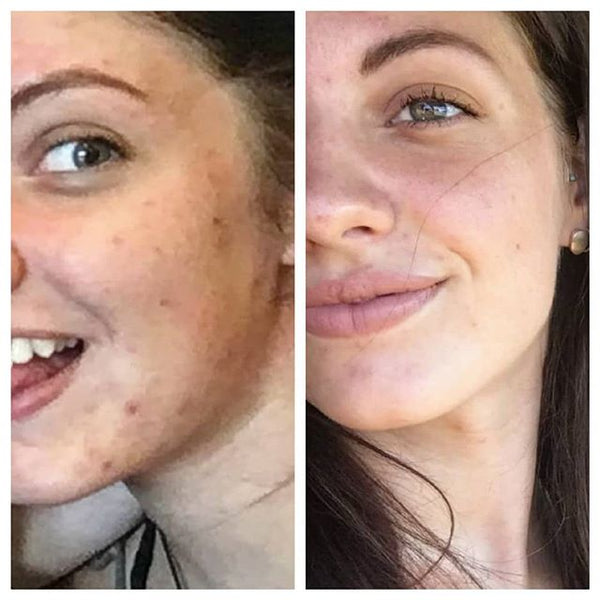 Thank you for your awesome skincare :)