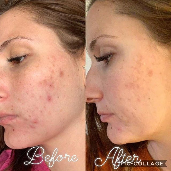After 3 weeks!