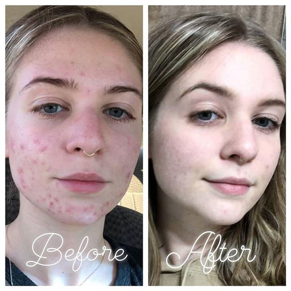 After 7 months!