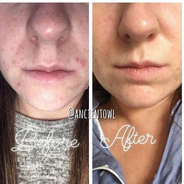 My skin feels and looks much better