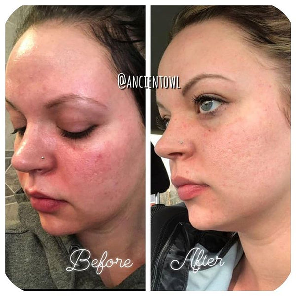 The cold cream has changed my life forever