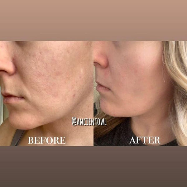 My skin feels incredibly soft