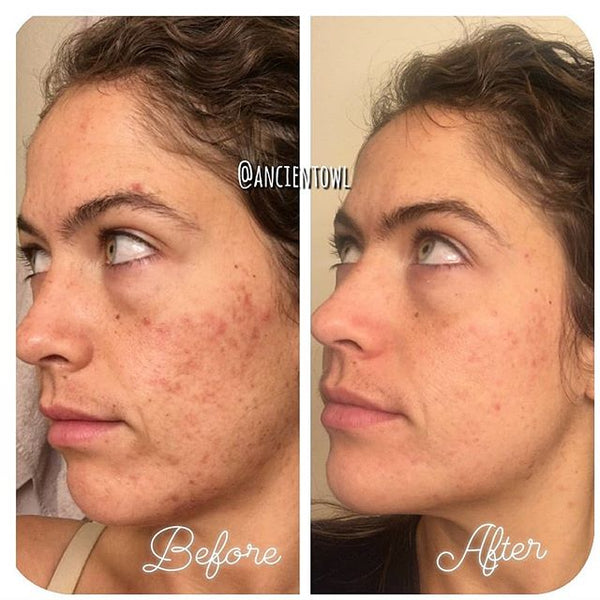 This cream really works magic