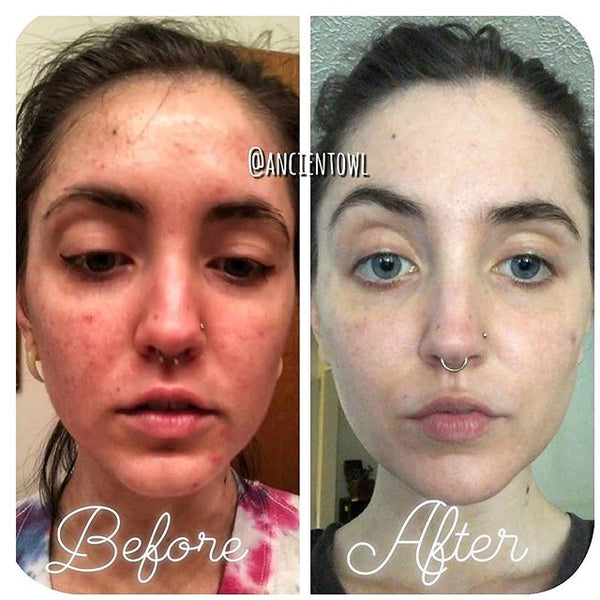 Second before and after