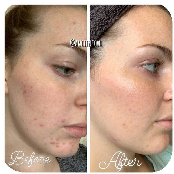6 month review