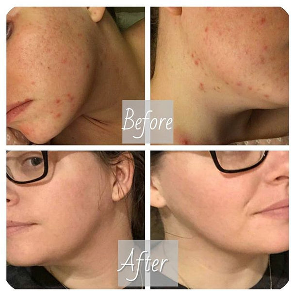 My skin has completely changed