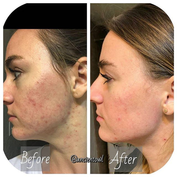 Cold Cream is changing my life!