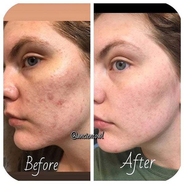 My skin looks and feels so much better!