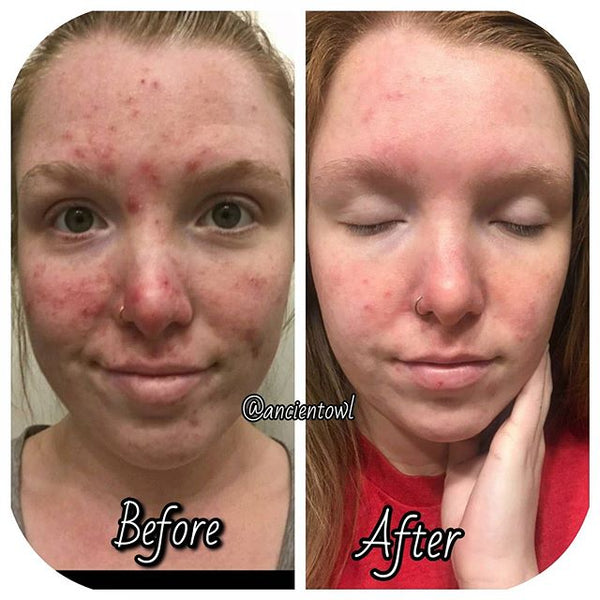 The purge stage is REAL, but don't give up!