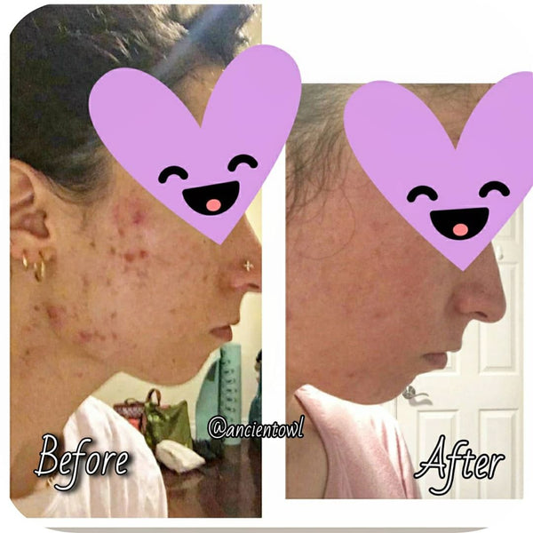 Ancient Owl has forever changed my skin