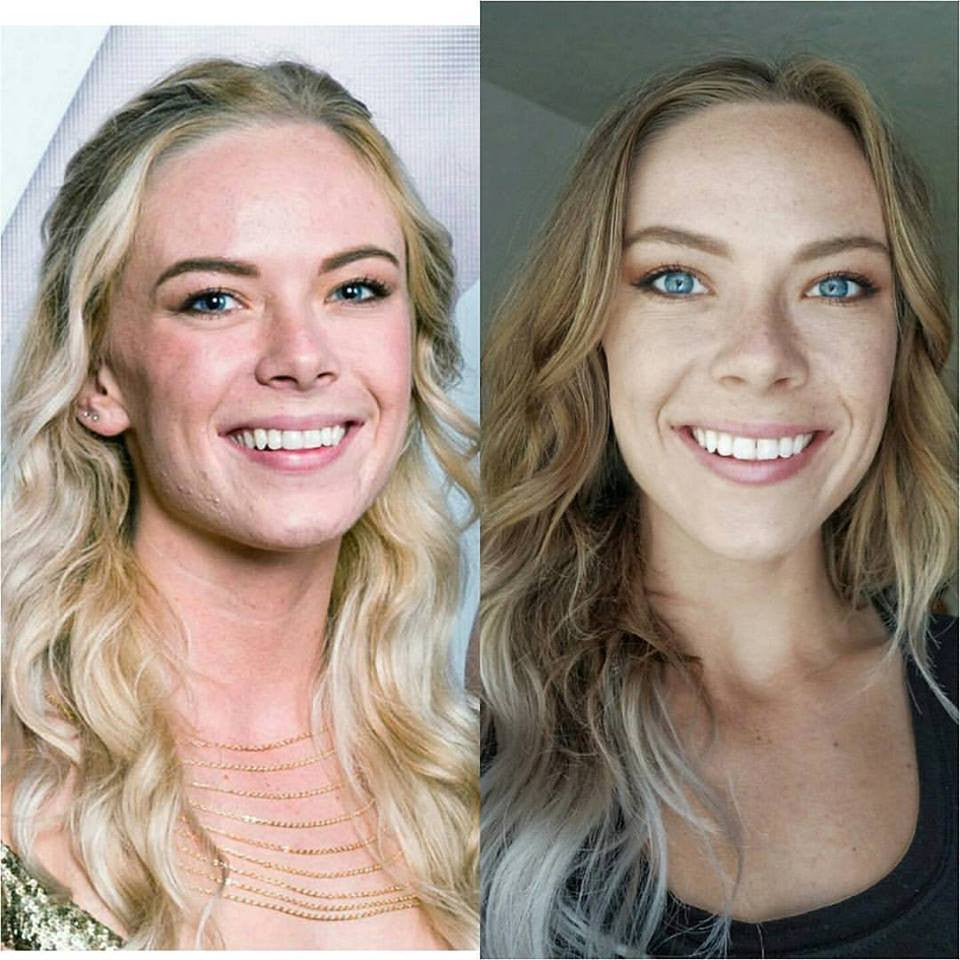 Cold Face Expression